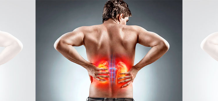 ¿Cuáles son los síntomas del cáncer de riñón?