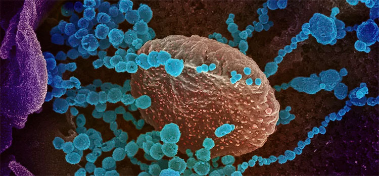 Las tremendas secuelas que viven pacientes recuperados del coronavirus