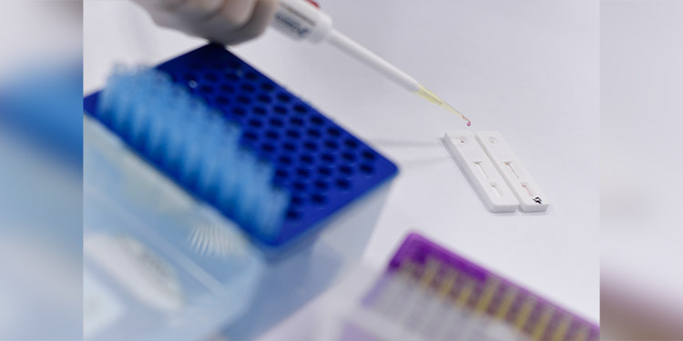 Venezuela recibe lote de vacuna rusa contra coronavirus para ensayo clínico