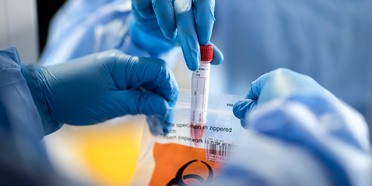 Infectólogo: en la reinfección se debe analizar el virus inicial y el recurrente