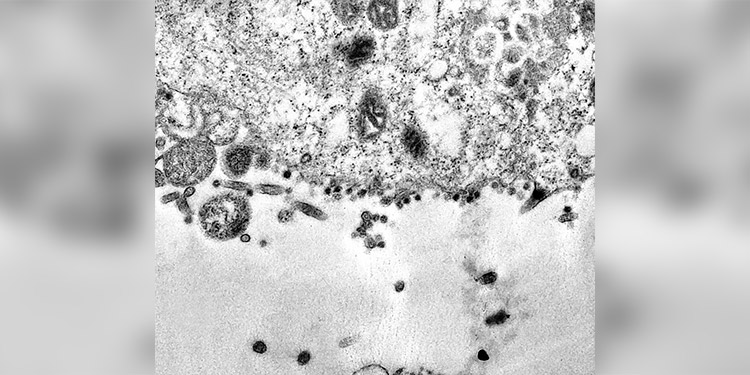 Captan en imágenes el momento exacto en que el coronavirus infecta una célula