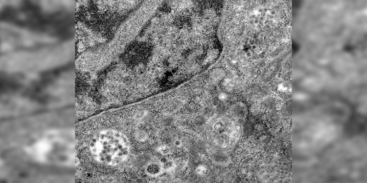 Captan en imágenes el momento exacto en que el coronavirus infecta una célula