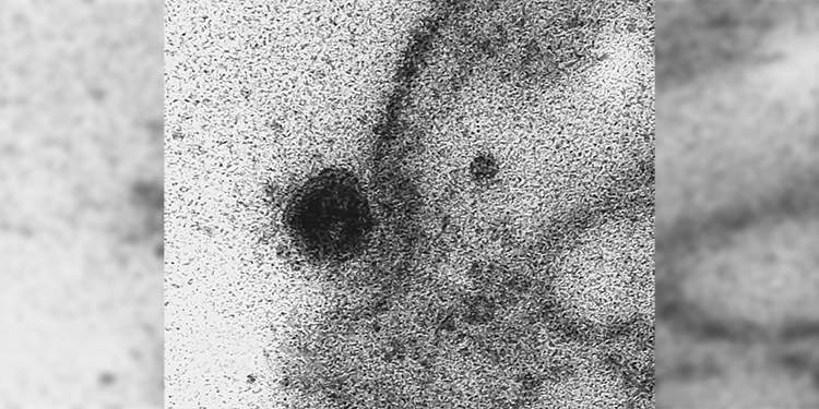 Captan en imágenes el momento exacto en que el coronavirus infecta una célula