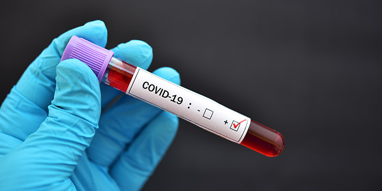 Laboratorio de Virología del IHSS sacará 72 resultados de PCR al día