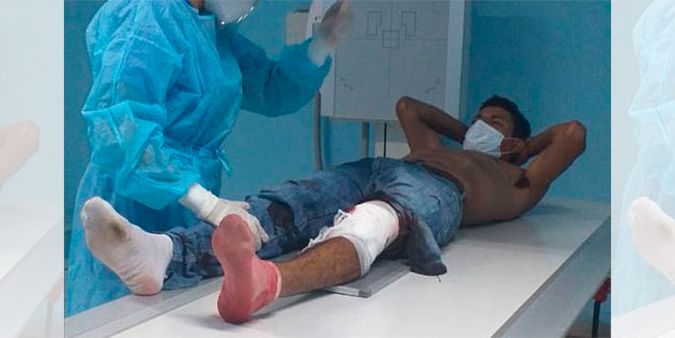 Supuesto asaltante resulta herido durante enfrentamiento con la Policía Nacional en El Paraíso