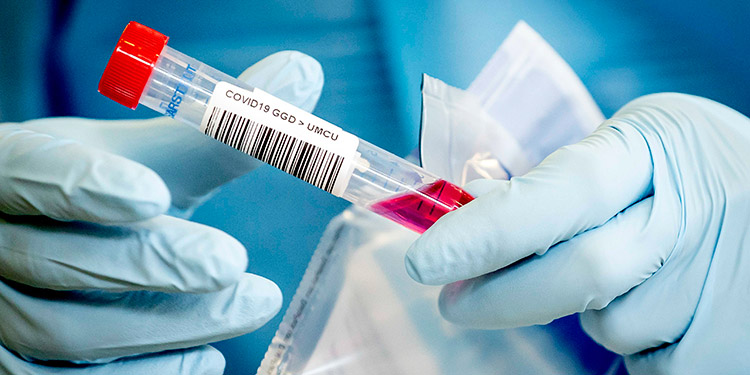 ¿Qué tipos de prueba de detección del coronavirus existen?