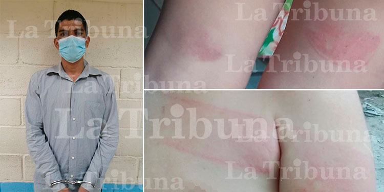 Hombre es arrestado por golpear a su hijo de cuatro años en Maraita