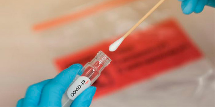 Abastecerán de más hisopos para pruebas PCR en SPS