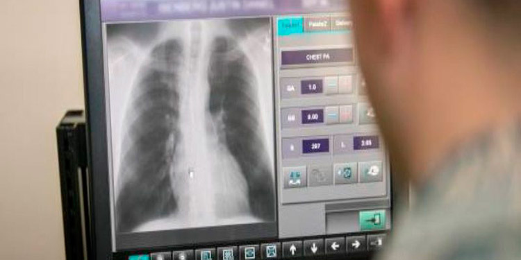 COVID-19 ataca al 30% de los técnicos en radiología de Honduras