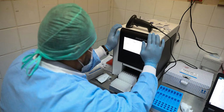 Máquinas deterioradas atrasan pruebas PCR