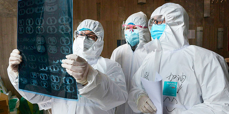 La COVID-19 afecta a distintas células del sistema inmunitario según la gravedad