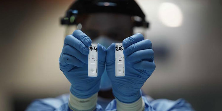 Los casos de coronavirus en el mundo superan los 34 millones