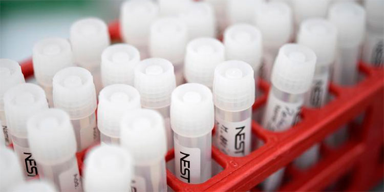 Confirman el primer caso de reinfección por COVID-19 en Estados Unidos