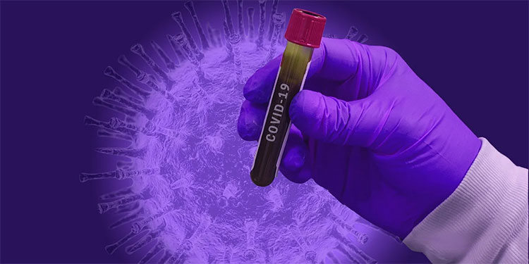 Identifican influencia genética e inmunológica en la gravedad de la COVID-19