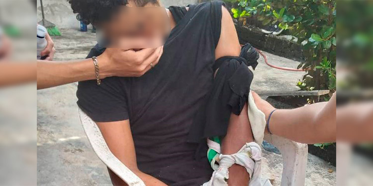 Hondureño casi pierde el brazo por machetazo durante riña en México