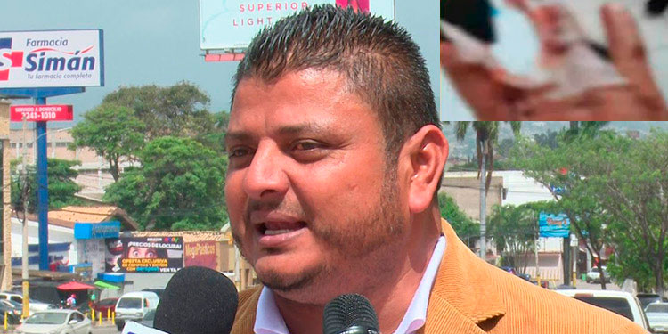 Presidente de Ataxish pierde uno de sus dedos por salvar a sus sobrinos