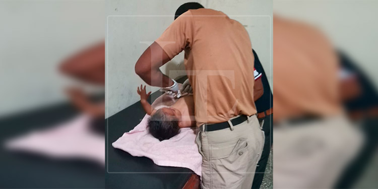 Niña de dos años resulta quemada con una ‘luz de bengala’ en Talanga